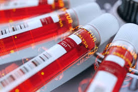 serology